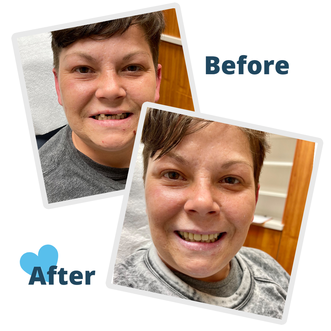 Before & After
